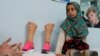 Anak perempuan Suriah, Maya Merhi (8 tahun), menunggu di pusat pembuatan kaki prostetik di Istanbul, Turki. Maya Merhi lahir tanpa kedua kaki karena kondisi bawaan sejak lahir. Setelah fotonya berjalan dengan &quot;kaki kaleng&quot; buatan ayahnya di kamp pengungsi Suriah viral, ia diundang ke Istanbul untuk pemasangan kaki prostetik.