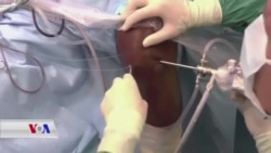 پێشکەوتنێکی نوێ لە بواری چارەسەرکردنی جومگەدا