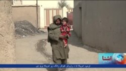 د ګوزڼ وبا؛ افغانستان کې سږکال ۱۶ ماشومان په ګوزڼ اخته شوي
