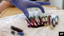 FILE - A nurse reaches for blood samples taken from a patient receiving immunotherapy at the Fred Hutchinson Cancer Research Center in Seattle, Washington, March 21, 2017.