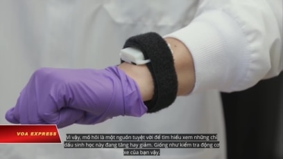Vòng đeo tay thông minh kiểm tra sức khỏe