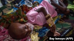 Seorang anak Papua yang menderita gizi buruk terbaring di ranjang rumah sakit untuk menjalani perawatan di Agats, ibu kota Kabupaten Asmat di Papua pada 26 Januari 2018. (Foto: AFP/Bay Ismoyo)