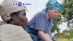 VOA60 Afrika: Kuendelea kwa mauwaji ya Albino yafichua kushindwa kwa polisi kulinda watu wake nchini Malawi