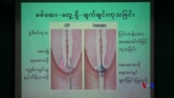 အမျိုးသမီးတွေသတိထားရမယ့် သားအိမ်ခေါင်းကင်ဆာ