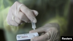 Zdravstveni radnik radi brzi antigenski test na aerodromu u Nici