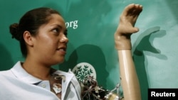 FILE - Claudia Mitchell, the first woman to receive a bionic arm, makes a shadow puppet with her new thought-controlled prosthetic hand at a news conference in Washington Sept. 14, 2006. 