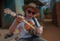 A Malawi musician with albinism, Lazarus Chigwandali, practices his guitar and drum before leaving his home at Likuni to go and perform at a market in the capital Lilongwe on May 10, 2019.