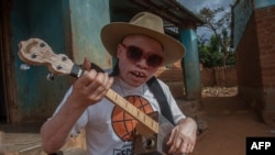 FILE: Representative illustration of albino African child. Taken May 10, 2019.