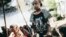 Somali child who lost a leg to a bomb explosion