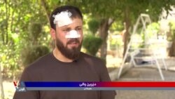 نەشتەرگەریەکی دەگمەن بۆ چاندنەوەی لووتی گەنجێک ئەنجام دەدرێت 