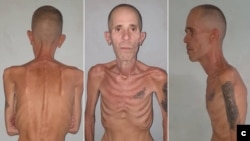 Alexander Díaz Rodríguez, Cuban political prisoner. (Photo courtesy Prisoners Defenders)