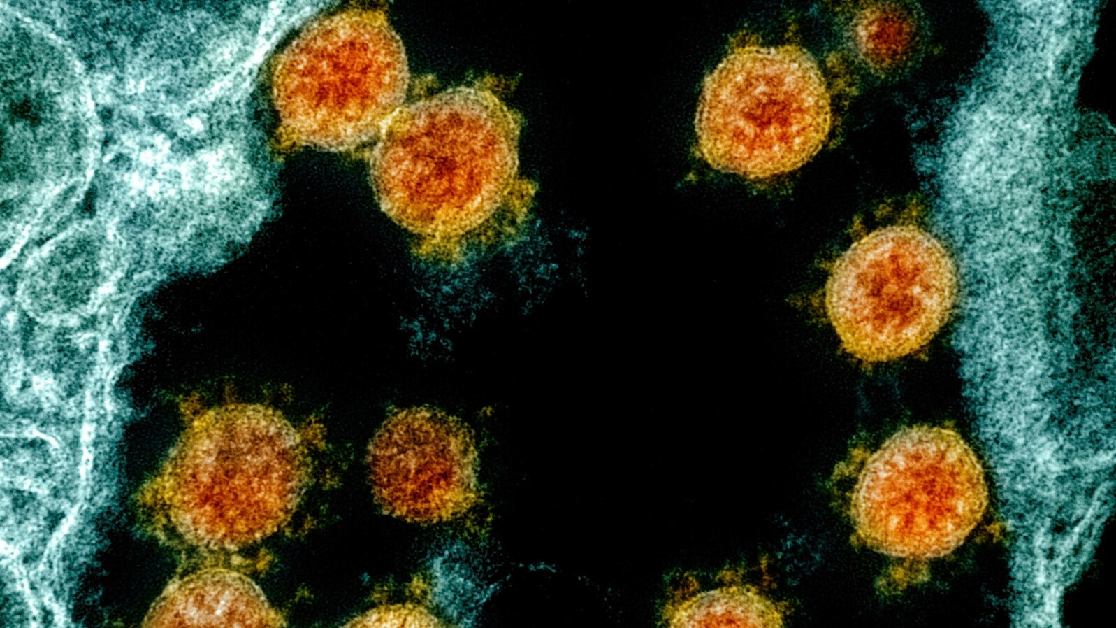 Stručnjaci su otkrili da virus opstaje na glatkim površinama pri temperaturi od 20 stepeni Celzijusa (Foto: NIAID/National Institutes of Health via AP) 