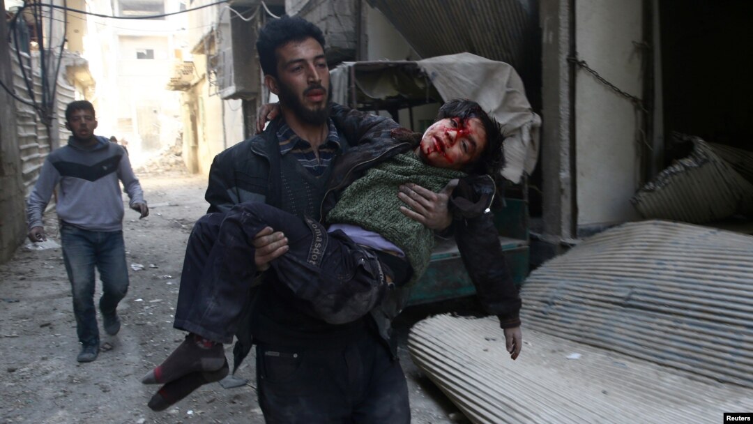 Seorang pria membopong anak laki-laki yang terluka di Kota Hamouriyeh, yang dikuasai dan dan dikepung pemberontak di timur Ghouta, dekat Damascus, Suriah, 21 Februari 2018.