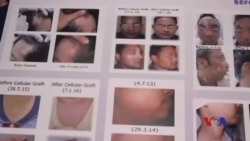 အသားရောင်ဆဲလ်တွေပျက်တဲ့ ခရုသင်းရောဂါ