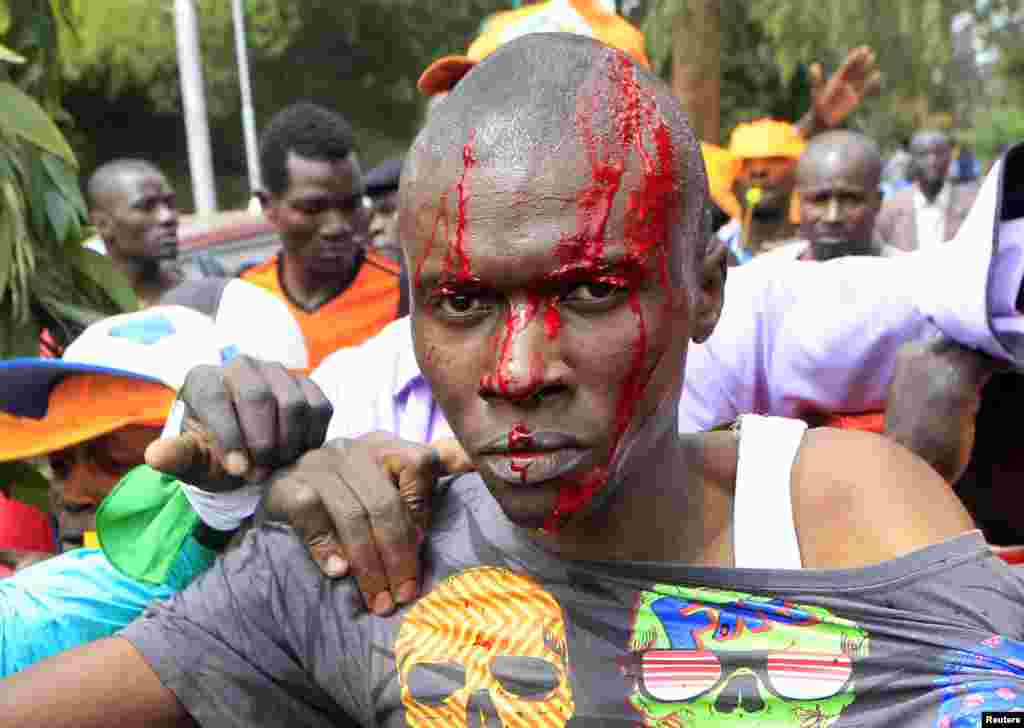 A supporter of Kenya's opposition Coalition for Reforms and Democracy bleeds from a head injury while engaging with riot police before the "Saba Saba Day" rally at the Uhuru park grounds in Nairobi, July 7, 2014. 