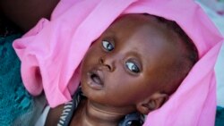 Malnourished five-month old Tiere Pascol lies in his mother's arms at a feeding center in Al Sabah Children's Hospital in Juba, South Sudan Dec. 3, 2020.