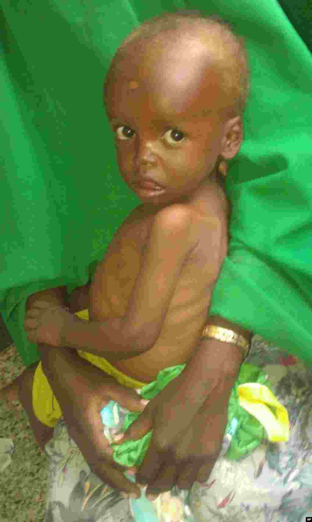 Banadir Hospital in Mogadishu, Somalia, 12 August 2011