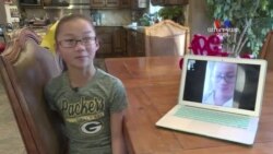 SHORT VIDEO: Նույնական երկվորյակները պատահաբար միավորվել են