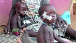 Researchers: Human Toll of South Sudan War 'As Bad As Iraq or Syria'