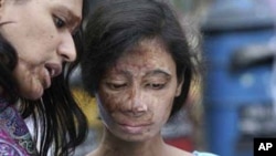 A survivor of an acid attack in Bangladesh. 