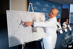 Dr. Hassan Nemeh, Surgical Director of Thoracic Organ Transplant, shows areas of a patient's lungs during a news conference at Henry Ford Hospital in Detroit, Nov. 12, 2019.