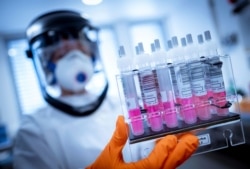 A research assistant holds coronavirus test samples in her hands at the Lower Saxony State Office for Consumer Protection and Food Safety (LAVES) in Hanover, Germany, April 1, 2020.