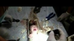Chinese Newborn Rescued from Sewage Pipe