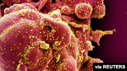 This colorized image captured by the NIAID Integrated Research Facility shows an apoptotic cell (red) infected with SARS-COV-2 virus particles (yellow), also known as novel coronavirus, isolated from a patient sample.