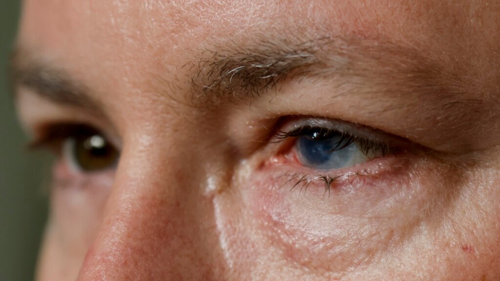 Experimental Treatment Promises to Heal Some Eye Injuries