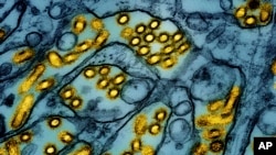 FILE - This colorized electron microscope image released by the National Institute of Allergy and Infectious Diseases on March 26, 2024, shows avian influenza A H5N1 virus particles (yellow), grown in Madin-Darby Canine Kidney epithelial cells (blue). 