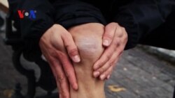 Knee Repair Experiment