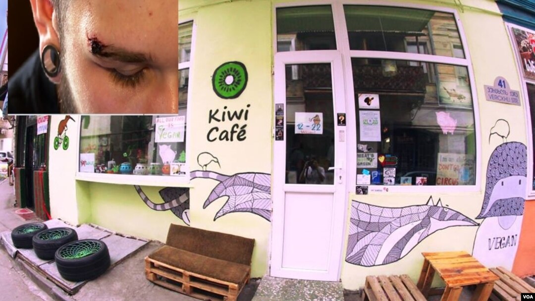 თავდასხმის შემდეგ ვეგეტარიანული კაფე დაკეტილია