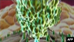 Mënyrë e re trajtimi për kancerin e prostatës