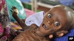 In this Tuesday, July 26, 2011 file photo, then seven month old Somali boy Minhaj Gedi Farah is treated in a field hospital of the International Rescue Committee (IRC) in Dadaab, Kenya. Somalia was hard hit by drought and parts of the country suffered fam