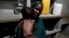 FILE PHOTO: A mother holds her severely malnourished child in South Kordofan, Sudan