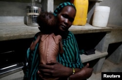 FILE - A mother holds her severely malnourished child at the pediatric ward of the Mother of Mercy Hospital in Gidel, South Kordofan, Sudan, June 25, 2024.