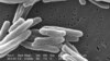 Esta imagen de microscopio de 2006 proporcionada por los Centros para el Control y la Prevención de Enfermedades muestran a la Mycobacterium tuberculosis, bacteria que causa la enfermedad de tuberculosis.
