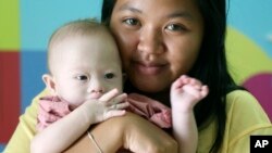 Pattaramon Chanbua, 21, poses her baby boy Gammy at a hospital in Chonburi province, southeastern Thailand Sunday, Aug. 3, 2014. 