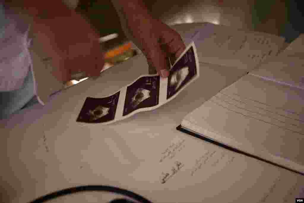 A doctor examines an ultrasound at a field hospital in the Za&#39;tari refugee camp. (Y. Weeks/VOA)