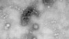 A Transmission Electron Microscopy image of the first isolated case of the coronavirus, as obtained by Reuters Jan. 27, 2020. 