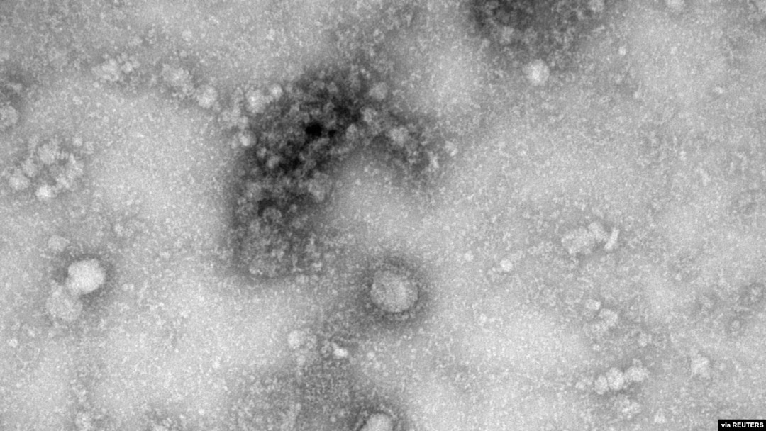 A Transmission Electron Microscopy image of the first isolated case of the coronavirus, as obtained by Reuters Jan. 27, 2020. 