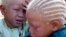 FILE - Albino twins beg for money at the entrance to the main mosque in Senegal's second city of Touba, March 29, 2005. 