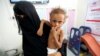 Calls for End to Yemen War Offer Little Hope for Hungry Children