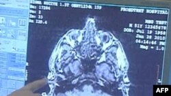 Một phụ nữ VN lãnh 12 năm tù vì tội đâm kim xuyên đầu em bé sơ sinh