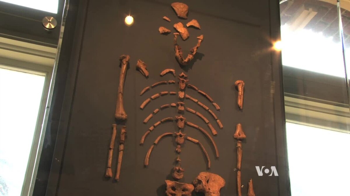 Harry & Lucy Skeleton Pair