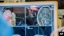 In this 2017 photo provided by the University of California, San Francisco, neurosurgeon Dr. Edward Chang is reflected in a computer monitor displaying brain scans as he performs surgery at UCSF. (Barbara Ries/UCSF via AP)