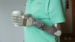 'Star Wars' Arm Improving Life for Amputees