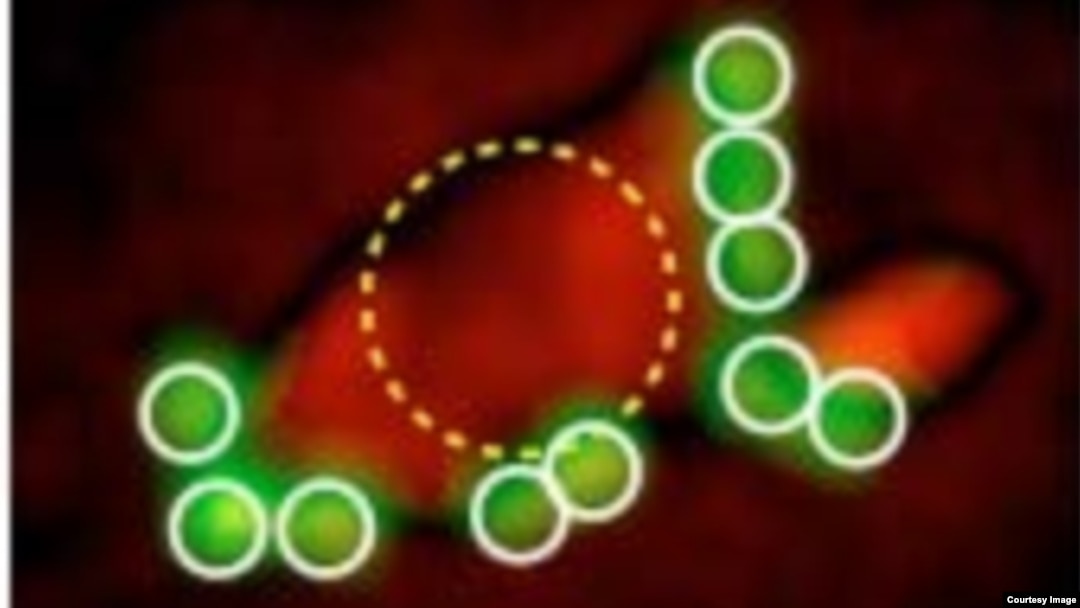 Dengan menghitung jumlah penanda tumor, sistem D3 mengkategorikan sampel-sampel biopsi leher rahim. (Massachusetts General Hospital Center for Systems Biology)